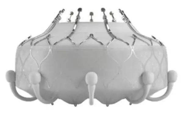Click Here To Enlarge This Photo Of Minimally Invasive Solutions for Tricuspid Valve Disease