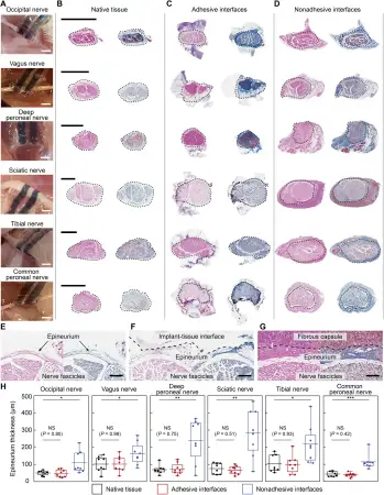 Click Here To Enlarge This Photo Of Advances in Bioelectronic Devices and Nonfibrotic Neural Interfaces